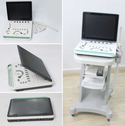 Laptop Ultrasound Scanner