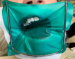 Dental Rubber Dam