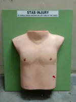 Stab injury